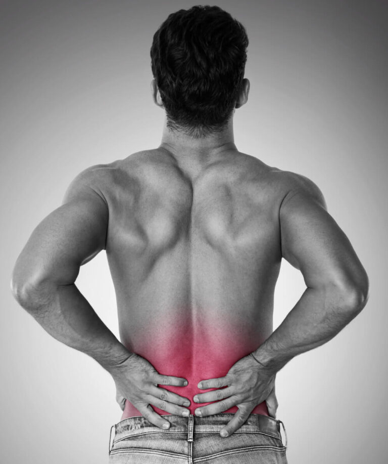 What is Sciatica